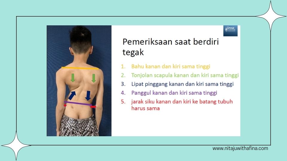 Pemeriksaan Skoliosis