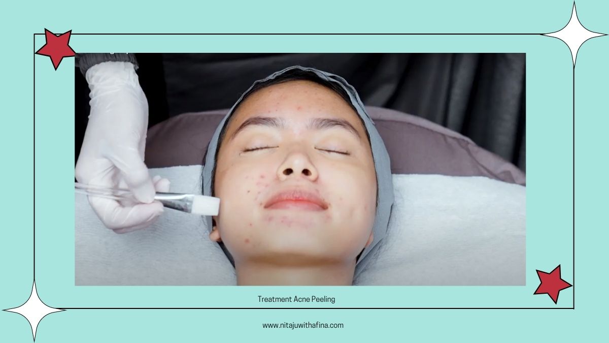 Perawatan di Erha Acne Center