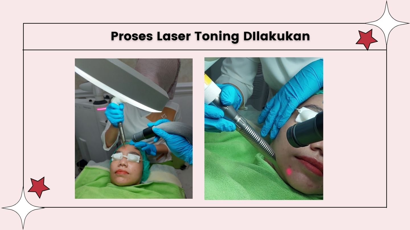 Laser Toning ZAP Clinic