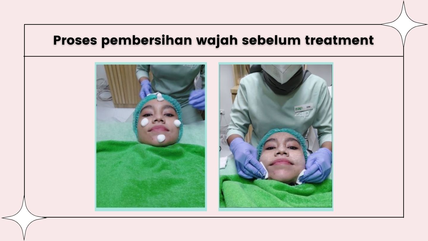 Wajah Sedang Dalam Proses Pembersihan di Klinik ZAP
