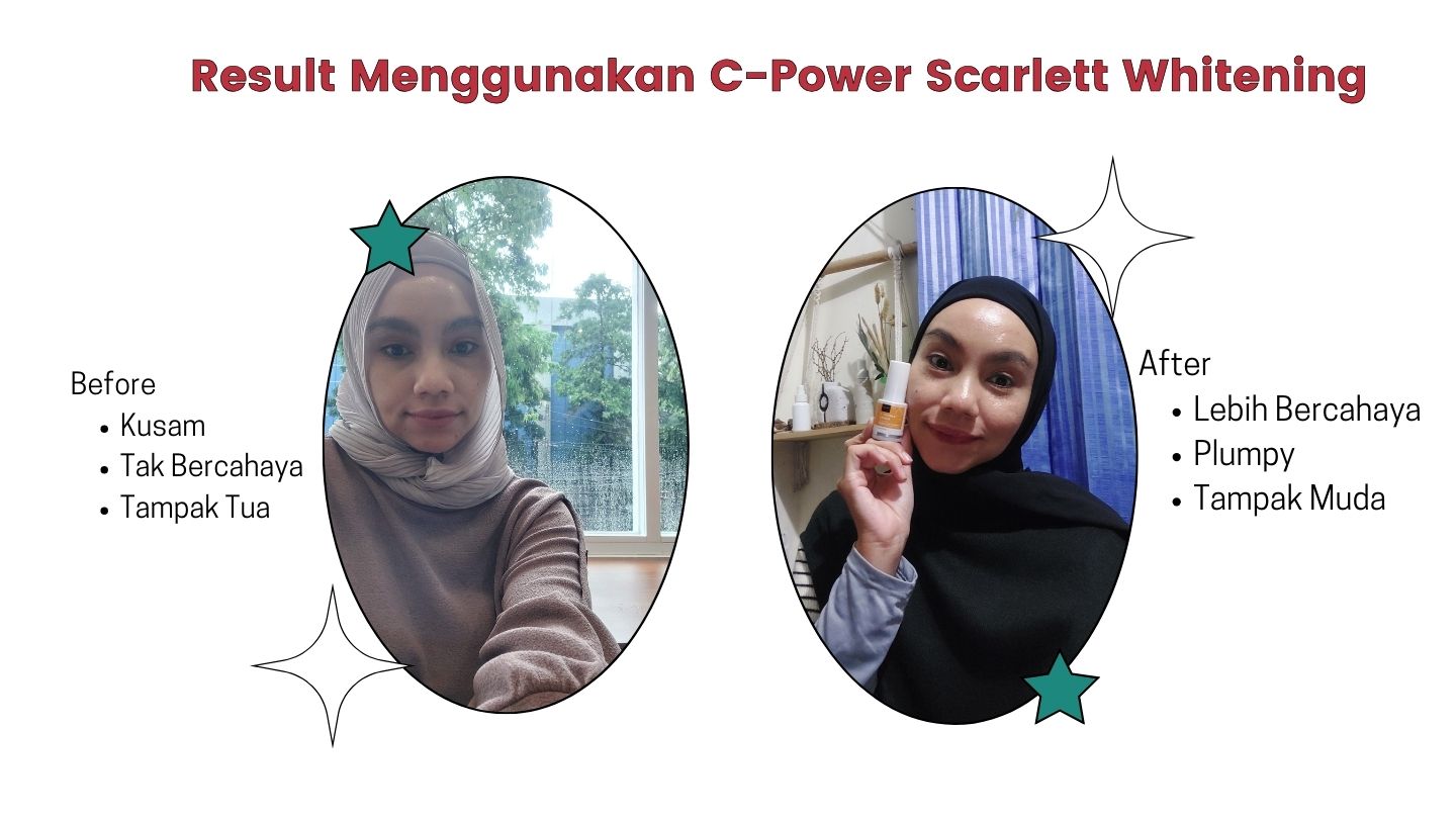Before After Penggunaan Scarlett Whitening C-Power Series