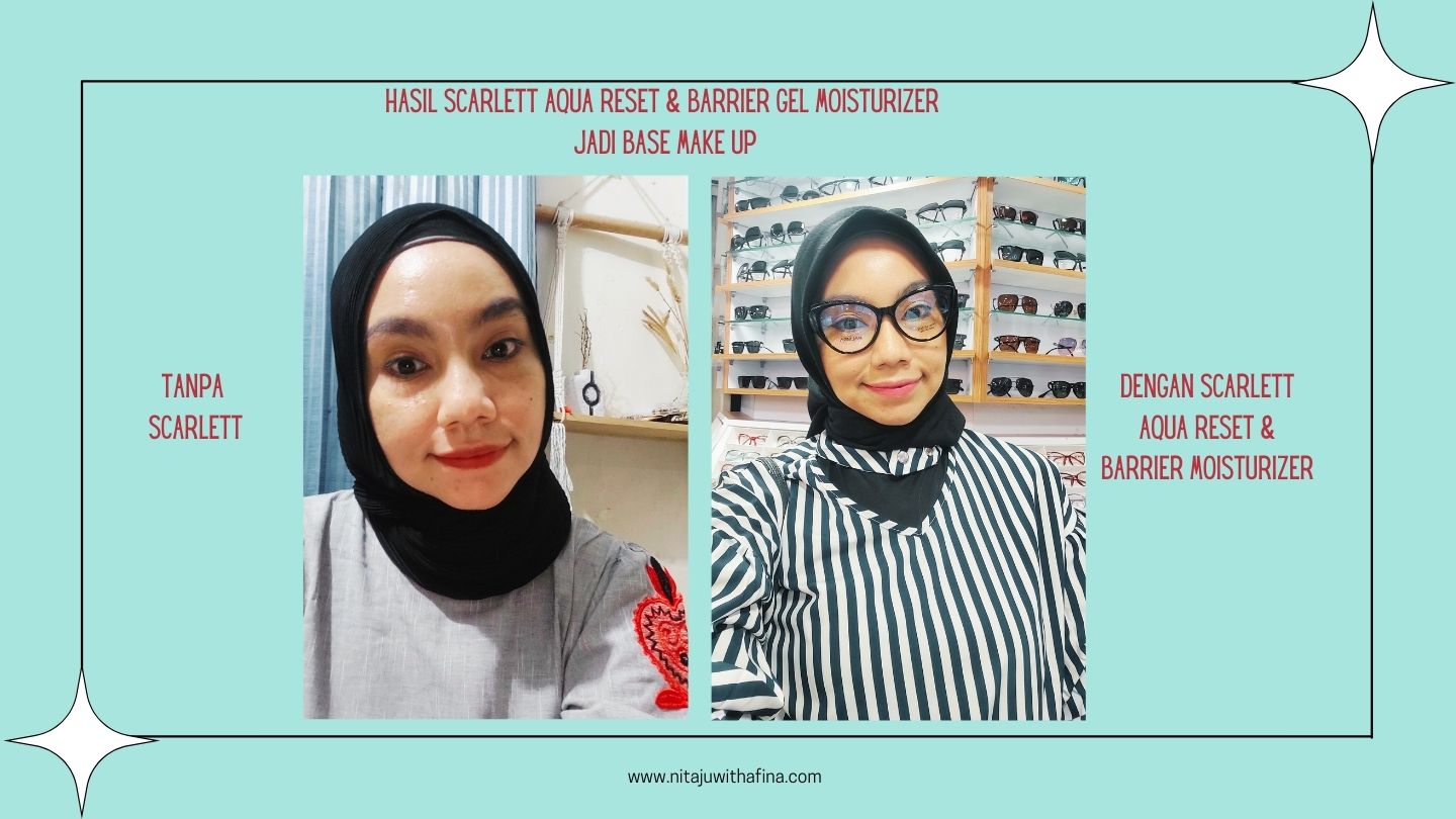 Before After Scarlett Aqua Reset & Barrier Gel Moisturizer